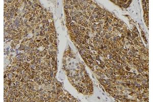 ABIN6278391 at 1/100 staining Human pancreas tissue by IHC-P. (MST1 antibody  (C-Term))
