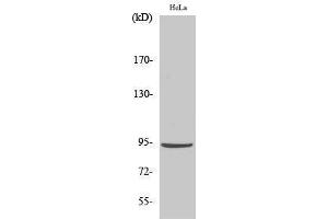 Western Blotting (WB) image for anti-Catenin, beta (CATNB) (Ser29) antibody (ABIN3183684) (beta Catenin antibody  (Ser29))