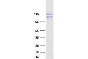 Validation with Western Blot (WWP2 Protein (Transcript Variant 2) (Myc-DYKDDDDK Tag))