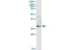 VDAC2 antibody  (AA 1-294)