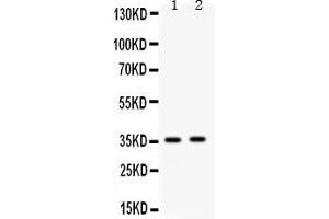 Western blot analysis of Apolipoprotein E expression in mouse spleen extract ( Lane 1) and mouse kidney extract ( Lane 2). (APOE antibody  (AA 55-294))