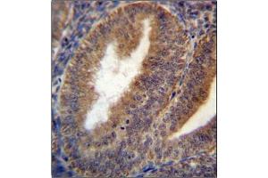 Immunohistochemistry analysis in Formalin Fixed and Paraffin Embedded Human uterus tissue using RRAGC Antibody (Center) followed by peroxidase conjugation of the secondary antibody and DAB staining. (GTR2 antibody  (Middle Region))