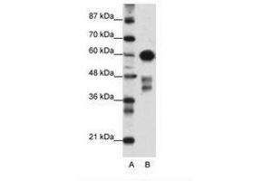 Image no. 1 for anti-Zinc Finger and SCAN Domain Containing 5A (AA 301-350) antibody (ABIN6736156) (ZSCAN5A antibody  (AA 301-350))