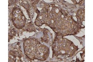 IHC analysis of SNAP23 using anti-SNAP23 antibody (ABIN7599089). (SNAP23 antibody  (AA 1-211))
