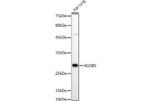 Western blot analysis of extracts of Rat lung, using HOXB5 antibody (ABIN7267769) at 1:510 dilution. (HOXB5 antibody  (AA 1-170))