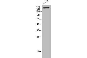 Western Blot analysis of Hela cells using Ron α Polyclonal Antibody (MST1R antibody  (N-Term))