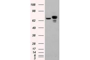 HEK293T cells were transfected with the pCMV6-ENTRY control (Left lane) or pCMV6-ENTRY CTNNB1 (RC208947) (Right lane) cDNA for 48 hrs and lysed. (CTNNB1 antibody  (AA 531-781))
