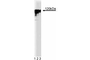 Western blot analysis of Eg5 on a human endothelial cell lysate. (KIF11 antibody  (AA 324-532))