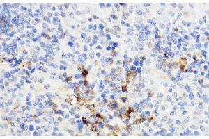 Immunohistochemistry of paraffin-embedded Rat spleen using YKL-40 / CHI3L1 Polyclonal Antibody at dilution of 1:100 (40x lens). (CHI3L1 antibody)