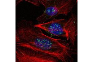 Immunofluorescence analysis of 3T3-L1 cells using MAP3K2 mouse mAb (green).