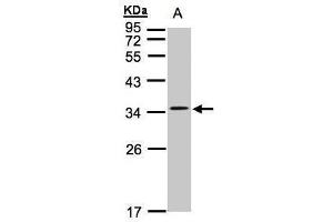 WB Image Sample(30 ug whole cell lysate) A:Hep G2 , 12% SDS PAGE antibody diluted at 1:1000 (CACNG5 antibody  (Center))