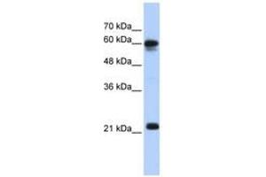 Image no. 1 for anti-Sema Domain, Immunoglobulin Domain (Ig), Transmembrane Domain (TM) and Short Cytoplasmic Domain, (Semaphorin) 4F (SEMA4F) (AA 91-140) antibody (ABIN6743418) (SEMA4F antibody  (AA 91-140))