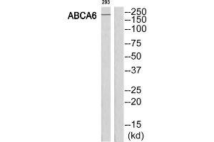 Western Blotting (WB) image for anti-ATP-Binding Cassette, Sub-Family A (ABC1), Member 6 (ABCA6) (C-Term) antibody (ABIN1850838) (ABCA6 antibody  (C-Term))