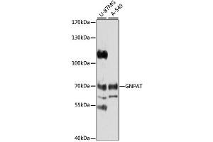 Western blot analysis of extracts of various cell lines, using GNPAT antibody (ABIN1872854) at 1:1000 dilution. (GNPAT antibody)