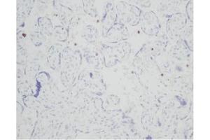 Immunohistochemistry (IHC) image for anti-Resistin (RETN) antibody (ABIN181156) (Resistin antibody)