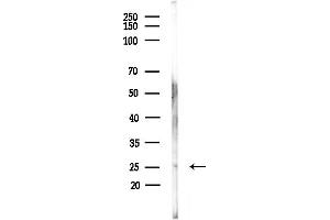 anti-Ras Association (RalGDS/AF-6) Domain Family Member 3 (RASSF3) (Internal Region) antibody