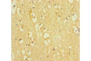Immunohistochemistry of paraffin-embedded human brain tissue using ABIN7172313 at dilution of 1:100 (TOX3 antibody  (AA 8-305))