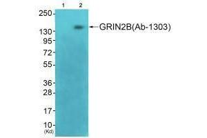 Western blot analysis of extracts from 3T3 cells (Lane 2), using GRIN2B (Ab-1303) antiobdy. (GRIN2B antibody  (Ser1303))
