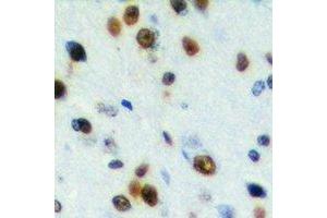 Immunohistochemical analysis of CABLES2 staining in human brain formalin fixed paraffin embedded tissue section. (CABLES2 antibody)