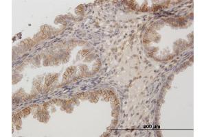 Immunoperoxidase of purified MaxPab antibody to CD44 on formalin-fixed paraffin-embedded human endometrium. (CD44 antibody  (AA 1-361))