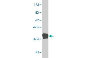 Western Blot detection against Immunogen (36. (BARX1 antibody  (AA 1-100))