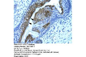 Human Spermatophore (HDAC2 antibody  (C-Term))