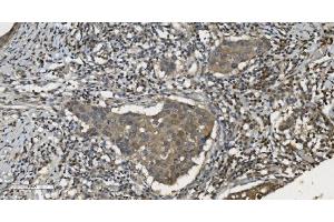 IHC analysis of MPI using anti-MPI antibody (ABIN7600514). (MPI antibody  (AA 2-99))