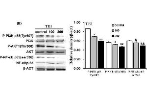 Qigesan inhibits PI3K/AKT and NF-κB signaling pathwayEca109 and TE1 cells were treated with QGS (0, 100, and 200 μg/mL) for 24 h. (AKT1 antibody  (pThr308))