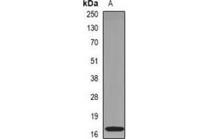 Western blot analysis of RNase 1 expression in mouse pancreas (A) whole cell lysates. (RNASE1 antibody)