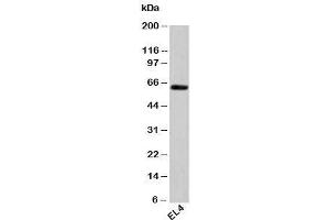 Western blot testing of mouse samples with HSP60 antibody at 1ug/ml. (HSPD1 antibody)