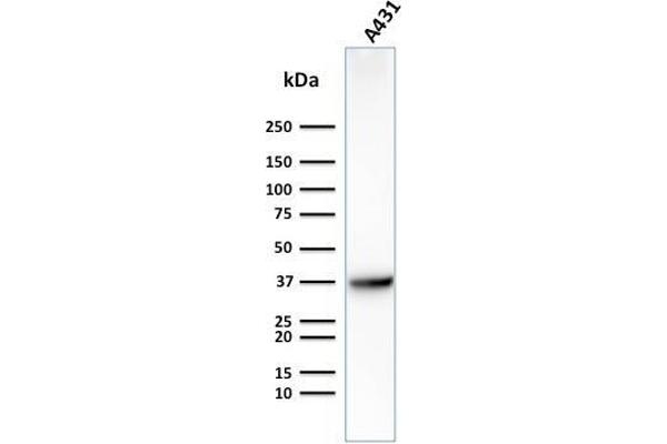 GLUT1 Antikörper  (AA 203-305)