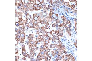 Immunohistochemistry of paraffin-embedded human liver using GOT2 Rabbit mAb (ABIN7267427) at dilution of 1:100 (40x lens). (GOT2 antibody)