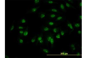 Immunofluorescence (IF) image for anti-C1D Nuclear Receptor Corepressor (C1D) (AA 1-141) antibody (ABIN564544)