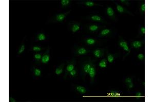 Immunofluorescence of monoclonal antibody to C1D on HeLa cell.