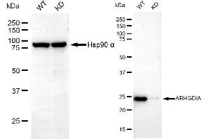 Western blotting analysis using ARHGDIA antibody (ABIN7800195). (Recombinant ARHGDIA antibody)