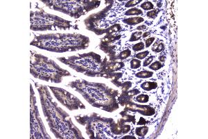 IHC analysis of SDHB using anti-SDHB antibody . (SDHB antibody  (AA 29-280))