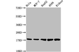 Western Blot Positive WB detected in: Hela whole cell lysate, MCF-7 whole cell lysate, HepG2 whole cell lysate, A549 whole cell lysate, Mouse kidney tissue All lanes: PBR antibody at 1. (Recombinant TSPO antibody)