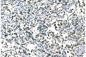 IHC analysis of B Raf/BRAF using anti-B Raf/BRAF antibody (ABIN3043761).