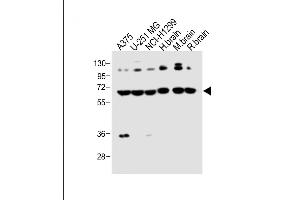 DLL3 antibody  (C-Term)