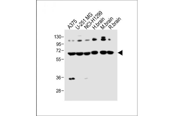 DLL3 antibody  (C-Term)