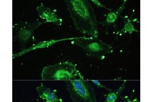 Immunofluorescence analysis of U-251MG cells using TREM2 Polyclonal Antibody at dilution of 1:100. (TREM2 antibody)
