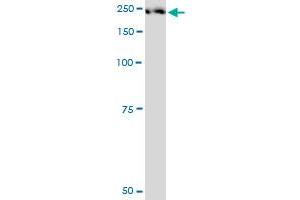 PLXNA2 monoclonal antibody (M06), clone 2G5. (Plexin A2 antibody  (AA 1-164))