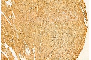 ABIN6264306 and ABIN6272878 at 1/100 staining Mouse heart tissue by IHC-P. (PLOD3 antibody  (C-Term))