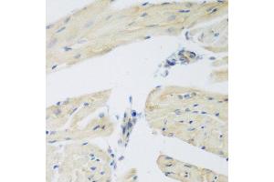 Immunohistochemistry of paraffin-embedded mouse heart using LEPREL2 antibody at dilution of 1:200 (40x lens).