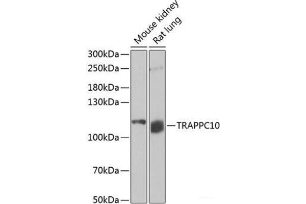 TRAPPC10 antibody