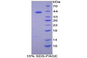 SDS-PAGE (SDS) image for Transferrin Receptor 2 (TFR2) (AA 4-87) protein (His tag,GST tag) (ABIN1099541)