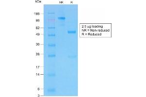SDS-PAGE Analysis of Purifed CFTR Rabbit Recombinant Monoclonal Antibody (CFTR/1775R).