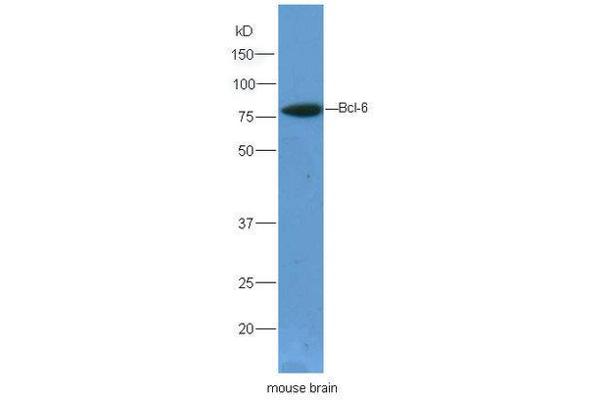 BCL6 antibody  (AA 501-600)