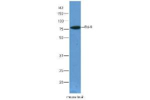 Lane 1:mouse brain lysates probed with Rabbit Anti-Bcl6 Polyclonal Antibody, Unconjugated  at 1:5000 for 90 min at 37˚C. (BCL6 antibody  (AA 501-600))