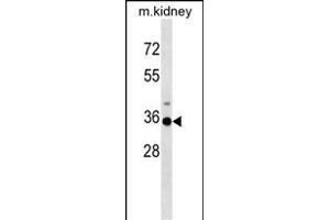 Mouse Hoxa3 Antibody (C-term) (ABIN1537304 and ABIN2848895) western blot analysis in mouse kidney tissue lysates (35 μg/lane). (HOXA3 antibody  (C-Term))
